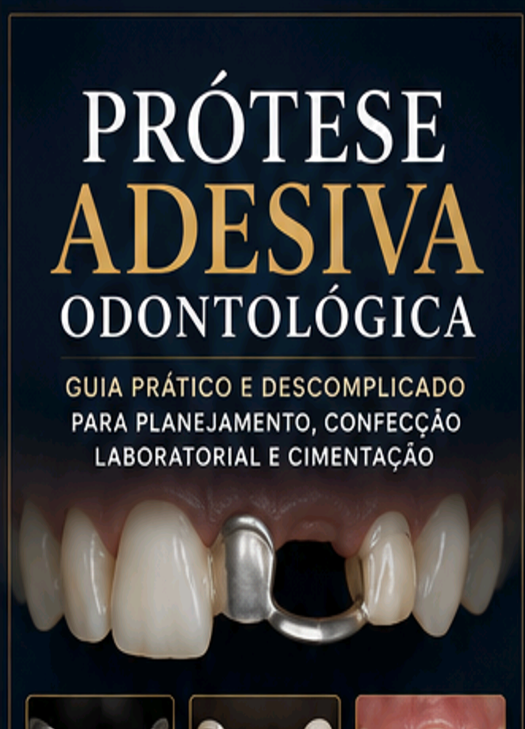 Capa do ebook Prótese Adesiva Odontológica — Guia Prático e Descomplicado